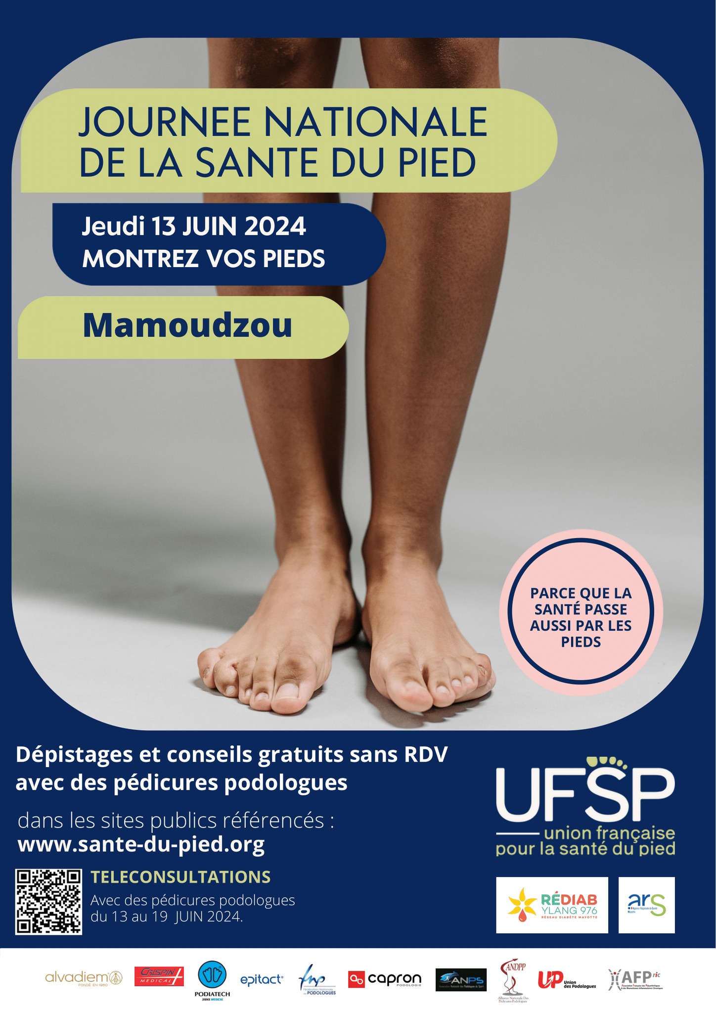 Le 13 juin, montrez vos pieds à Mamoudzou !